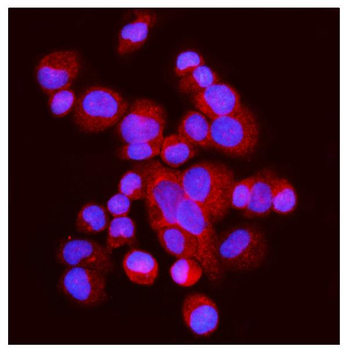 FABP-1/GOT2/FABP Rabbit Polyclonal Antibody