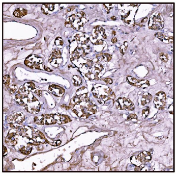 FABP-1/GOT2/FABP Rabbit Polyclonal Antibody