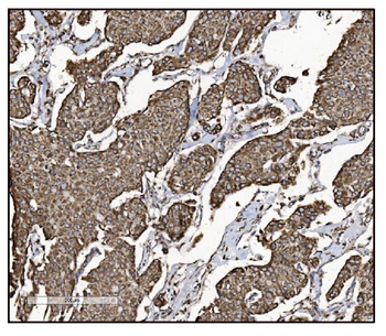 FABP-1/GOT2/FABP Rabbit Polyclonal Antibody
