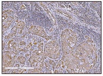 FABP-1/GOT2/FABP Rabbit Polyclonal Antibody