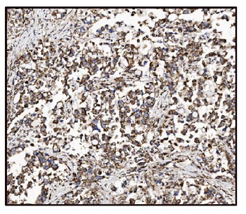 FABP-1/GOT2/FABP Rabbit Polyclonal Antibody