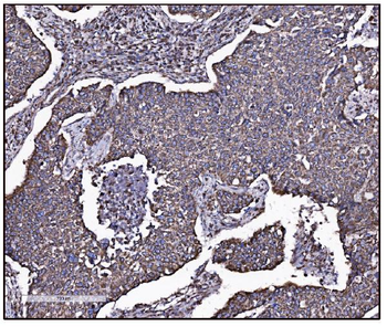 FABP-1/GOT2/FABP Rabbit Polyclonal Antibody