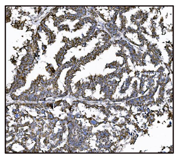 FABP-1/GOT2/FABP Rabbit Polyclonal Antibody