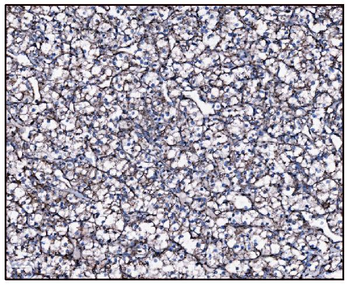 FABP-1/GOT2/FABP Rabbit Polyclonal Antibody
