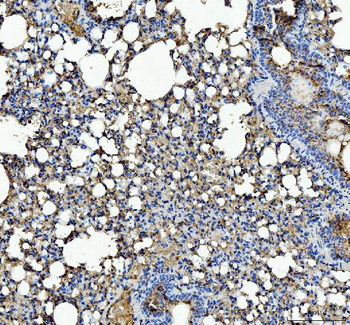 IL1RA/Il1rn Rabbit Polyclonal Antibody