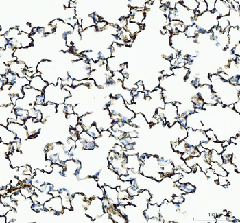 IL1RA/Il1rn Rabbit Polyclonal Antibody
