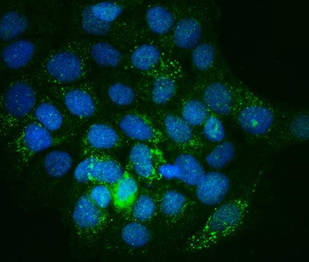 Integrin linked ILK Rabbit Polyclonal Antibody