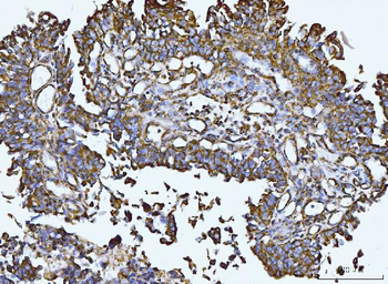 Integrin linked ILK Rabbit Polyclonal Antibody