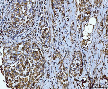 Integrin linked ILK Rabbit Polyclonal Antibody