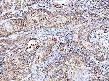 Integrin linked ILK Rabbit Polyclonal Antibody