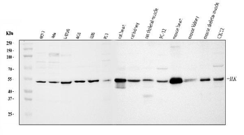 Integrin linked ILK Rabbit Polyclonal Antibody
