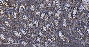 MIEF1 Rabbit Polyclonal Antibody