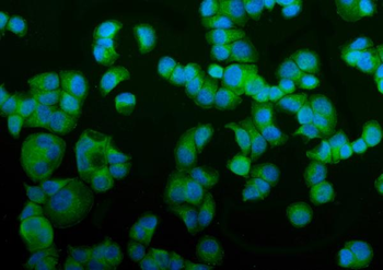 NSF Rabbit Polyclonal Antibody