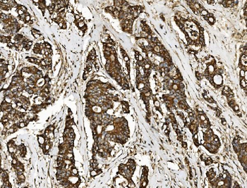 NSF Rabbit Polyclonal Antibody