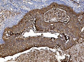 NSF Rabbit Polyclonal Antibody