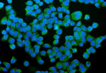 P4HB Rabbit Polyclonal Antibody