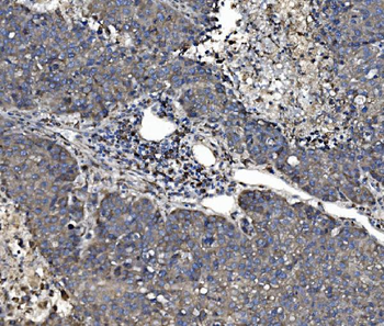 P4HB Rabbit Polyclonal Antibody