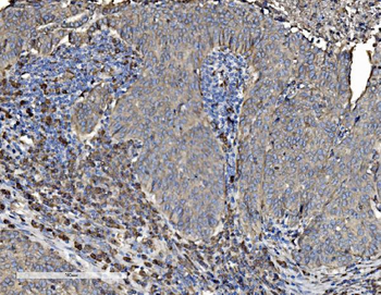 P4HB Rabbit Polyclonal Antibody