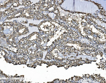 P4HB Rabbit Polyclonal Antibody