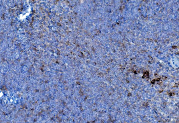 P4HB Rabbit Polyclonal Antibody