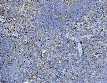 P4HB Rabbit Polyclonal Antibody