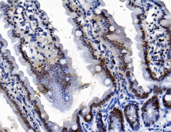 TMS1/ASC/Pycard Rabbit Polyclonal Antibody