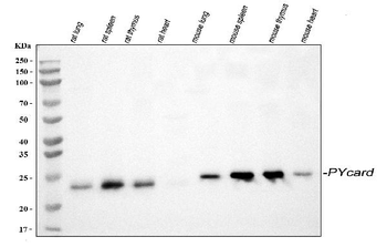 TMS1/ASC/Pycard Rabbit Polyclonal Antibody
