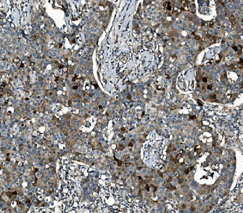 SEC14L3/TAP2 Rabbit Polyclonal Antibody