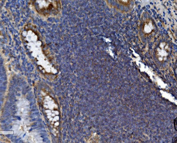 SEC14L3/TAP2 Rabbit Polyclonal Antibody