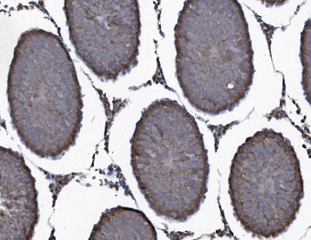 SEC14L3/TAP2 Rabbit Polyclonal Antibody