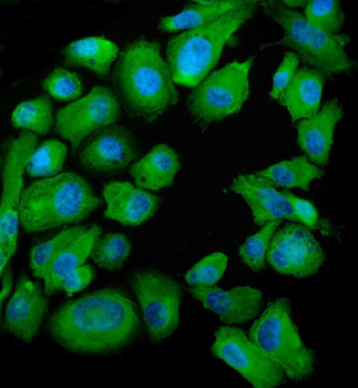 SND1 Rabbit Polyclonal Antibody