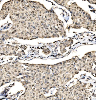 SND1 Rabbit Polyclonal Antibody