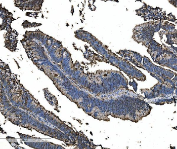 Astrin/Deepest/SPAG5 Rabbit Polyclonal Antibody