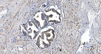 STIL/SIL Rabbit Polyclonal Antibody