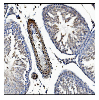 TAGLN/Transgelin Rabbit Polyclonal Antibody