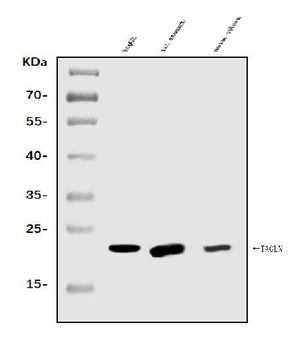 TAGLN/Transgelin Rabbit Polyclonal Antibody