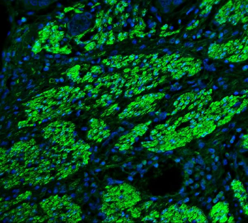 TAGLN/Transgelin Rabbit Polyclonal Antibody