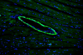 TAGLN/Transgelin Rabbit Polyclonal Antibody