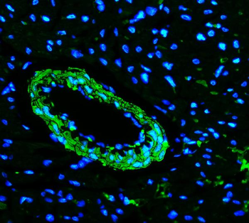 TAGLN/Transgelin Rabbit Polyclonal Antibody
