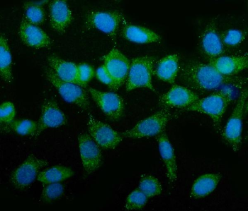TAGLN/Transgelin Rabbit Polyclonal Antibody