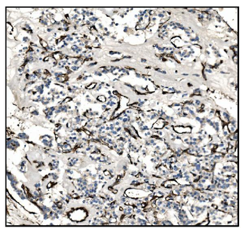 TAGLN/Transgelin Rabbit Polyclonal Antibody