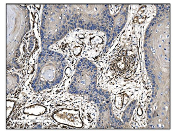 TAGLN/Transgelin Rabbit Polyclonal Antibody