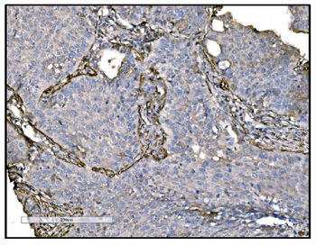 TAGLN/Transgelin Rabbit Polyclonal Antibody
