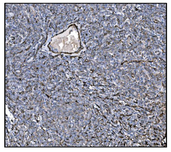 TAGLN/Transgelin Rabbit Polyclonal Antibody