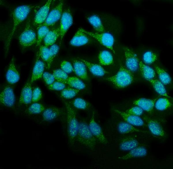 DAI/ZBP1 Rabbit Polyclonal Antibody