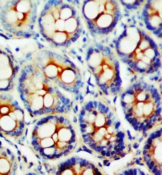 Somatostatin Receptor 1/SSTR1 Rabbit Polyclonal Antibody