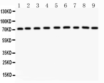 Growth hormone receptor/GHR Rabbit Polyclonal Antibody