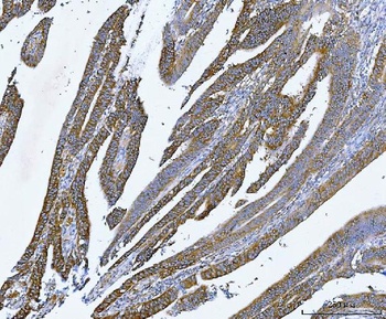 YB1/YBX1 Rabbit Polyclonal Antibody