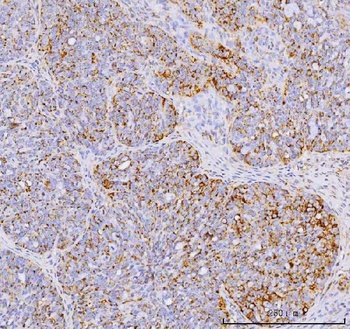 YB1/YBX1 Rabbit Polyclonal Antibody