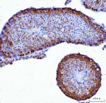 YB1/YBX1 Rabbit Polyclonal Antibody